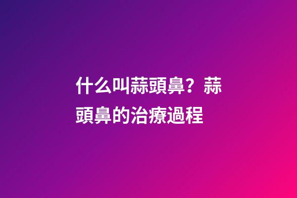 什么叫蒜頭鼻？蒜頭鼻的治療過程