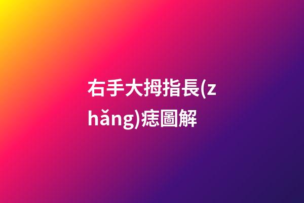 右手大拇指長(zhǎng)痣圖解