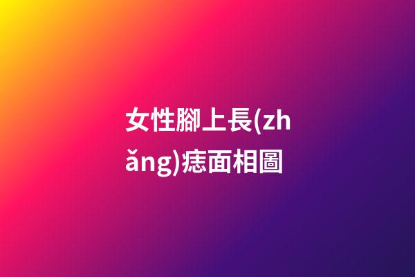 女性腳上長(zhǎng)痣面相圖