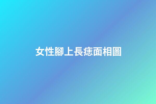 女性腳上長痣面相圖
