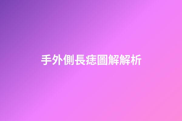 手外側長痣圖解解析