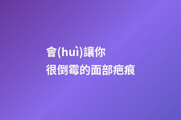 會(huì)讓你很倒霉的面部疤痕