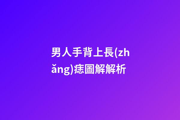 男人手背上長(zhǎng)痣圖解解析