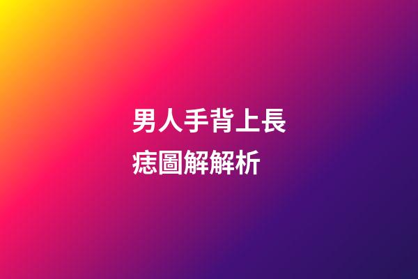 男人手背上長痣圖解解析