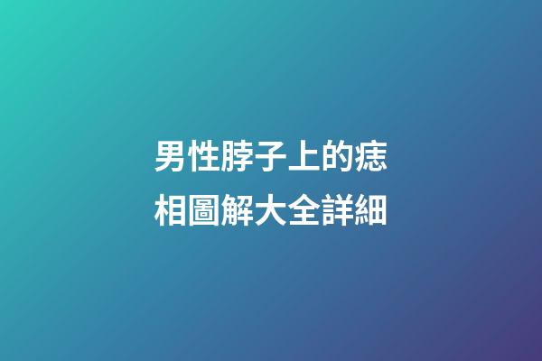 男性脖子上的痣相圖解大全詳細