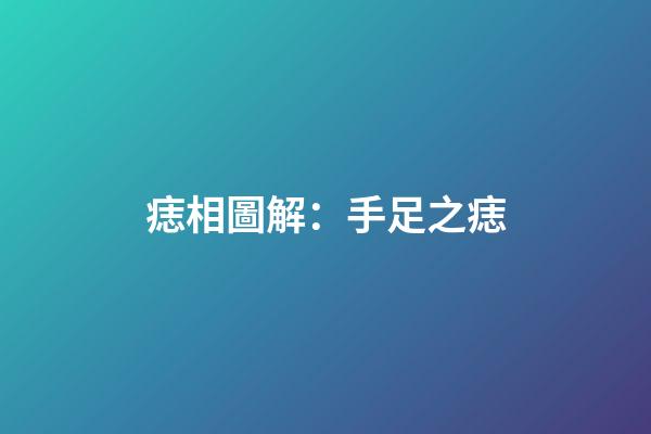 痣相圖解：手足之痣