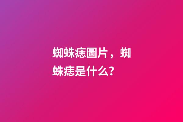 蜘蛛痣圖片，蜘蛛痣是什么？