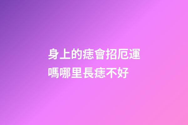 身上的痣會招厄運嗎?哪里長痣不好?