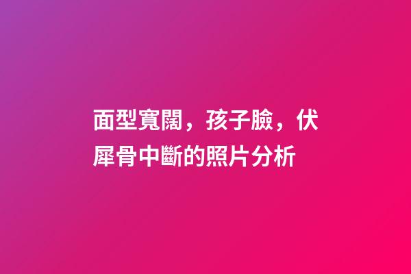 面型寬闊，孩子臉，伏犀骨中斷的照片分析